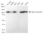 MVP Antibody in Western Blot (WB)