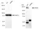 MADD Antibody in Western Blot (WB)