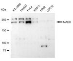 MADD Antibody in Western Blot (WB)