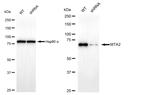 MTA2 Antibody in Western Blot (WB)