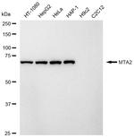 MTA2 Antibody in Western Blot (WB)