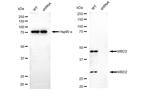 MBD2 Antibody in Western Blot (WB)