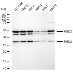 MBD2 Antibody in Western Blot (WB)