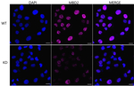 MBD2 Antibody in Immunocytochemistry (ICC/IF)
