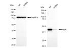 MVK Antibody in Western Blot (WB)