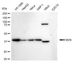 MVK Antibody in Western Blot (WB)