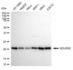 NDUFB9 Antibody in Western Blot (WB)