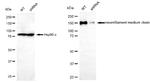 NEFM Antibody in Western Blot (WB)