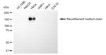 NEFM Antibody in Western Blot (WB)