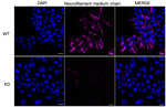 NEFM Antibody in Immunocytochemistry (ICC/IF)