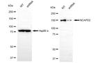 NCAPD2 Antibody in Western Blot (WB)