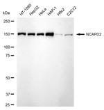 NCAPD2 Antibody in Western Blot (WB)