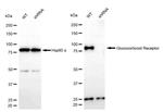 Glucocorticoid Receptor Antibody in Western Blot (WB)
