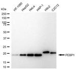 PEBP1 Antibody in Western Blot (WB)