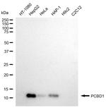 PCBD1 Antibody in Western Blot (WB)