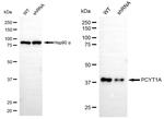PCYT1A Antibody in Western Blot (WB)