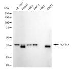 PCYT1A Recombinant Rabbit Monoclonal Antibody (24GB5015)
