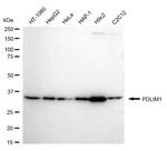 PDLIM1 Antibody in Western Blot (WB)