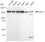 MNAR Antibody in Western Blot (WB)