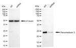 PRDX3 Antibody in Western Blot (WB)