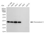 PRDX3 Antibody in Western Blot (WB)
