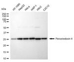 PRDX4 Recombinant Rabbit Monoclonal Antibody (24GB1570)