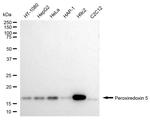 PRDX5 Antibody in Western Blot (WB)