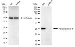 PRDX6 Antibody in Western Blot (WB)