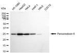 PRDX6 Antibody in Western Blot (WB)