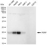 PERP Recombinant Rabbit Monoclonal Antibody (24GB1630)