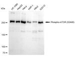 Phospho-mTOR (Ser2448) Antibody in Western Blot (WB)