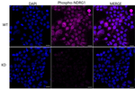 Phospho-NDRG1 (Ser330) Antibody in Immunocytochemistry (ICC/IF)