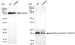 Phospho-Presenilin 1 (Ser310) Antibody in Western Blot (WB)