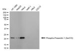 Phospho-Presenilin 1 (Ser310) Antibody in Western Blot (WB)