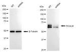 CALM Antibody in Western Blot (WB)