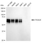 CALM Recombinant Rabbit Monoclonal Antibody (24GB1620)