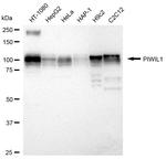 PIWIL1 Recombinant Rabbit Monoclonal Antibody (24GB1545)