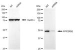 PPP2R5E Antibody in Western Blot (WB)