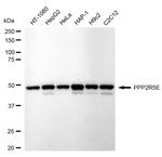 PPP2R5E Antibody in Western Blot (WB)