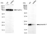 Presenilin 1 Antibody in Western Blot (WB)