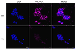 PRKAR2A Antibody in Immunocytochemistry (ICC/IF)