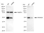 PRKAR2A Antibody in Western Blot (WB)