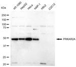 PRKAR2A Antibody in Western Blot (WB)