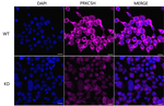 PRKCSH Antibody in Immunocytochemistry (ICC/IF)