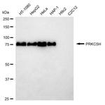 PRKCSH Antibody in Western Blot (WB)
