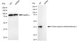PRMT1 Antibody in Western Blot (WB)