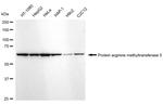PRMT5 Antibody in Western Blot (WB)