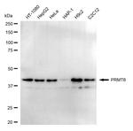 PRMT6 Recombinant Rabbit Monoclonal Antibody (24GB1585)