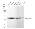 PAR4 Antibody in Western Blot (WB)