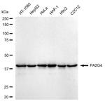 EBP1 Antibody in Western Blot (WB)